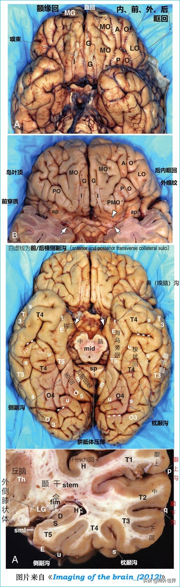 脑解剖学讲解视频全集,脑功能解剖学习