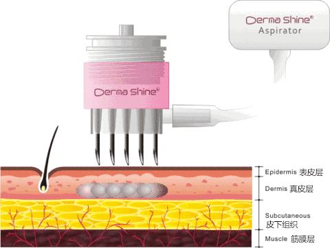 春季脸上干燥泛红发痒起皮怎么办,脸上干燥起皮泛红用什么补水