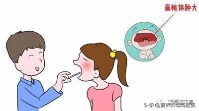 扁桃体炎经过抗炎治疗几天能好,扁桃体发炎中医辨证治疗