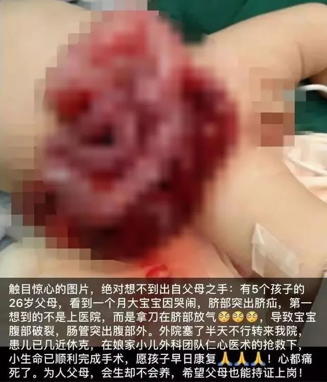 宝宝肚脐鼓起一个大包,宝宝肚脐鼓包