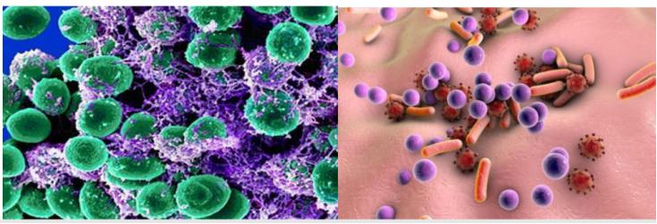 引起女性私密疾病原因有哪些？