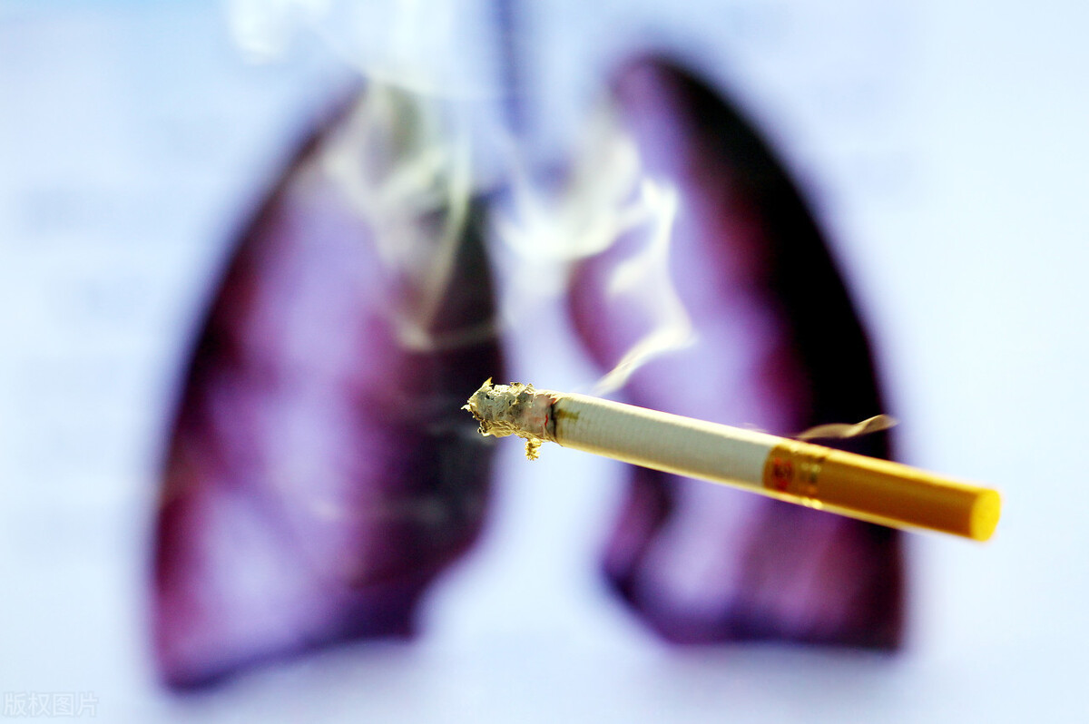 哪些人是易患肺癌的高危人群呢,这4类肺癌高危人群建议定期检查