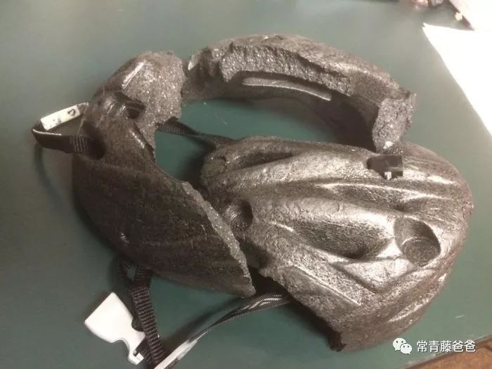 小朋友在美国险些脑袋开花，全靠麻省这条法律捡回一条命