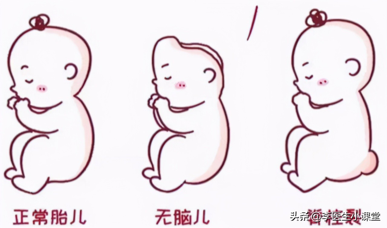 补叶酸过量有什么害处,补充叶酸的好处与坏处