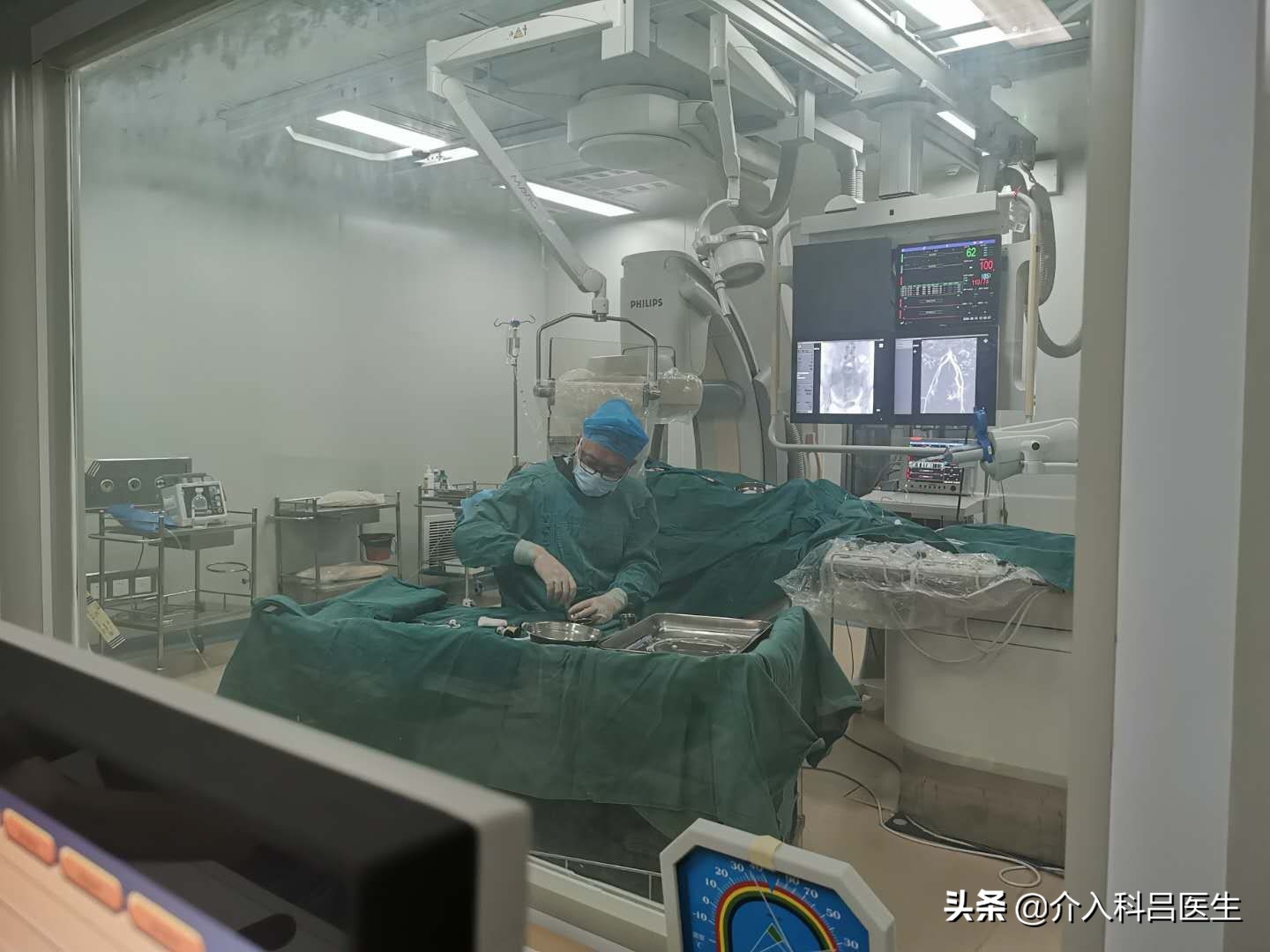 不死的癌症子宫腺肌瘤,子宫腺肌症介入栓塞效果和后遗症