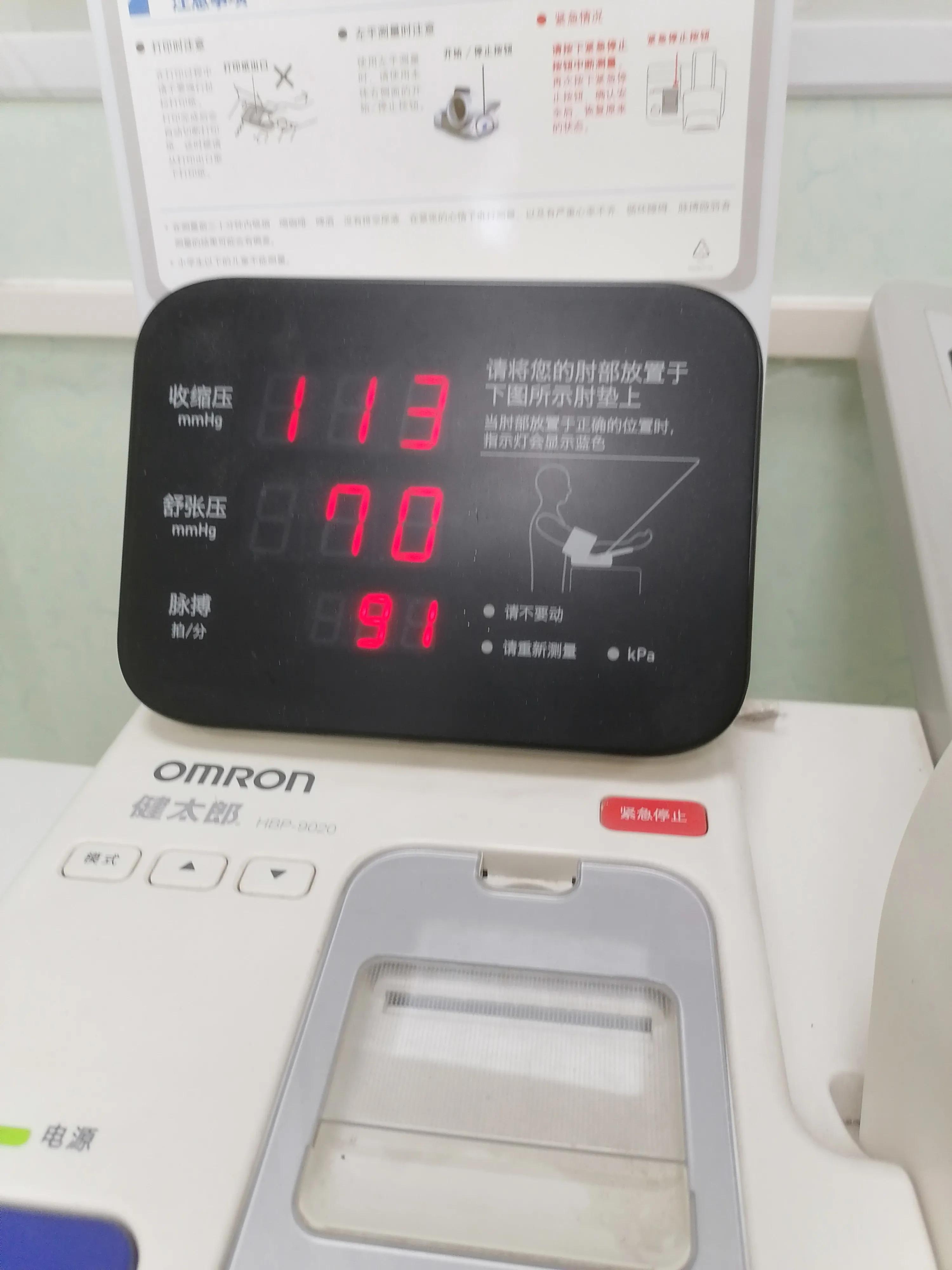 孕35周一星期做两次胎监好吗,怀孕35周做产检胎监多少分才合格