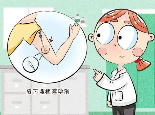 女性避孕方式有几种方法,未婚女性避孕最佳方式