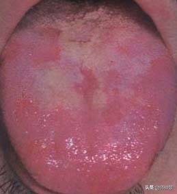 最实用的舌诊图六大舌象,舌诊深入学习书