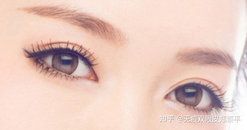 割双眼皮几毫米最好看,割双眼皮真的会好看吗
