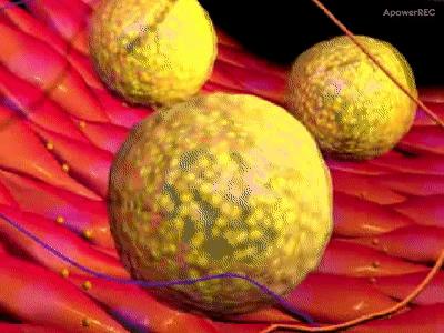 降胆固醇和降血脂最快的十种食物,八种食物降血脂降血压