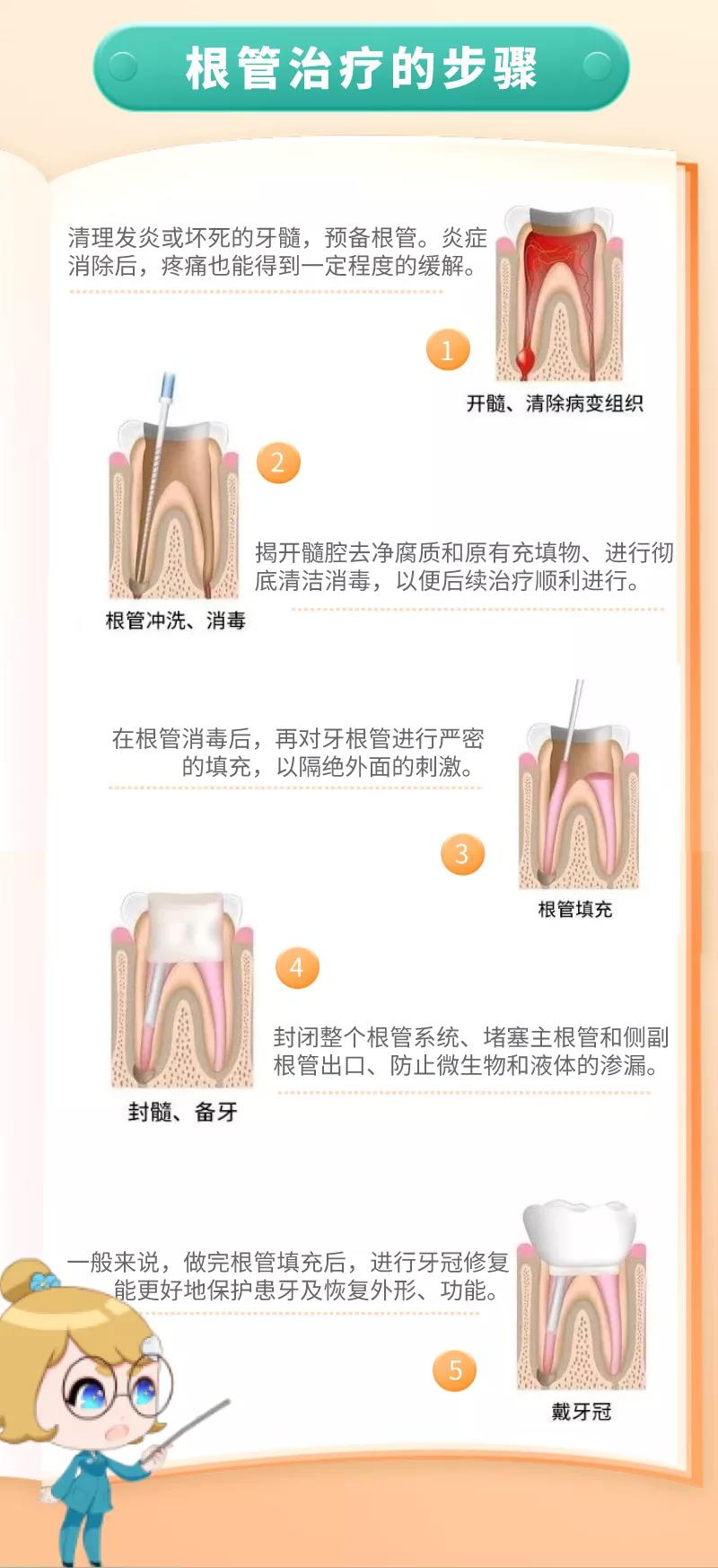 做了根管治疗后,该怎么选择牙冠?有哪几种修复方式可选?