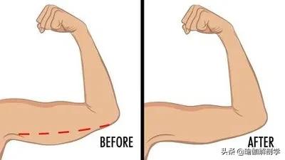 瘦手臂紧致是练瑜伽还是健身,瑜伽每天必练8个动作瘦手臂