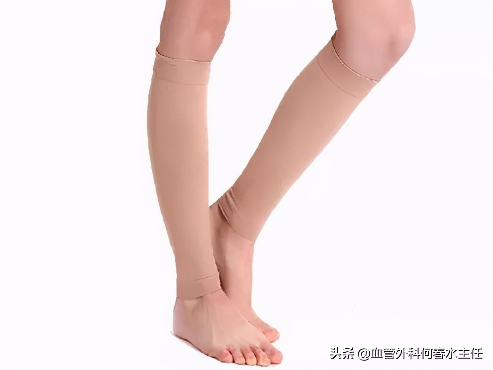 静脉曲张，早期治疗至关重要