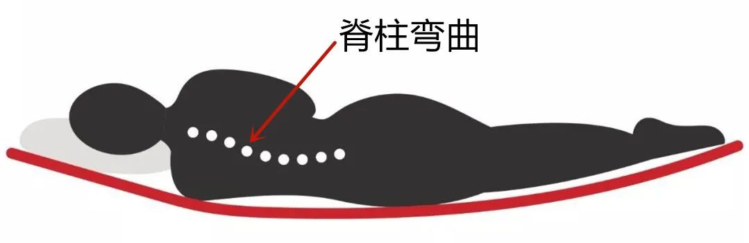 10岁小朋友睡硬床好还是软床好,腰椎手术后睡硬床好还是软床好呢