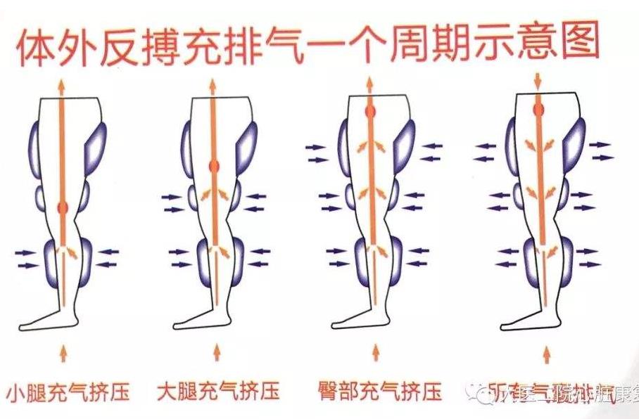 体外反搏能缓解心律失常吗,体外反搏舒服吗