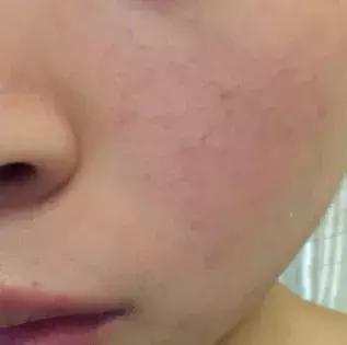 明星童颜秘诀，每1秒卖出10瓶的TA，素人高呼有效淡纹、去暗沉！