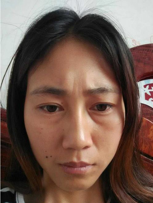 28岁的小丫皮肤缺水宛如老大妈，学会这样护肤，巧变女神肌