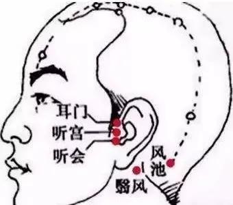 神经性耳聋耳鸣穴位注射,康复理疗电针灸