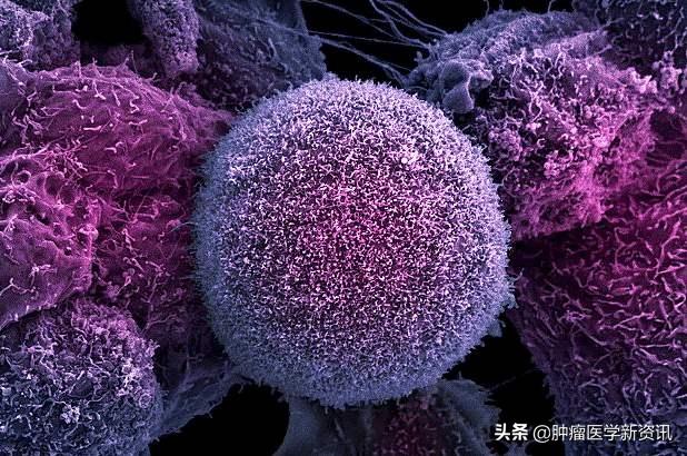 赴日治疗癌症,赴日本治疗癌症机构