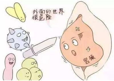 宫颈炎通常在什么情况下会有,宫颈炎如果严重了是什么症状