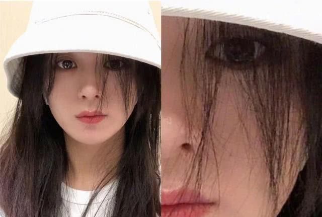 赵丽颖眼睛肿是怎么回事,赵丽颖眼睛长麦粒肿是因为拍戏吗