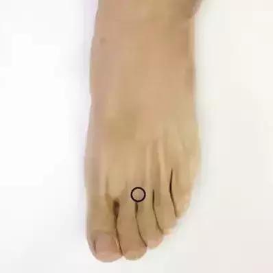 胡希恕经方治疗乳腺增生,中医治疗乳腺增生的处方