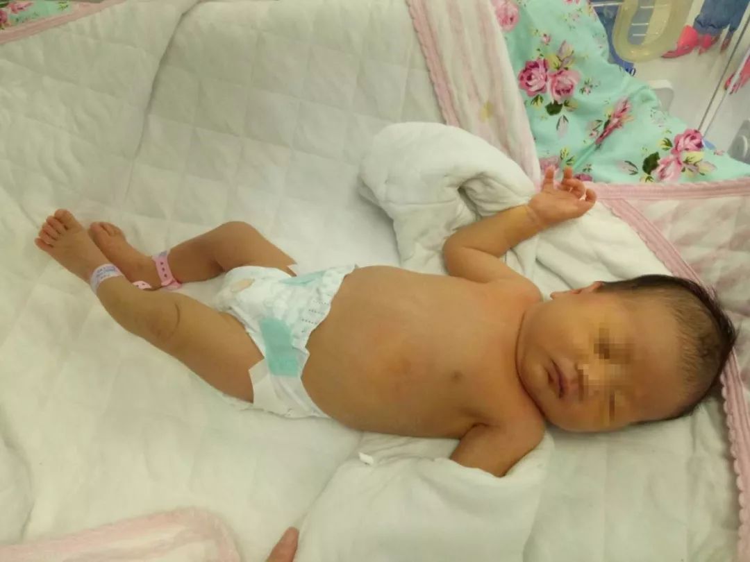 新生儿肚脐眼要不要清理,新生儿肚脐眼有脓是怎么清理