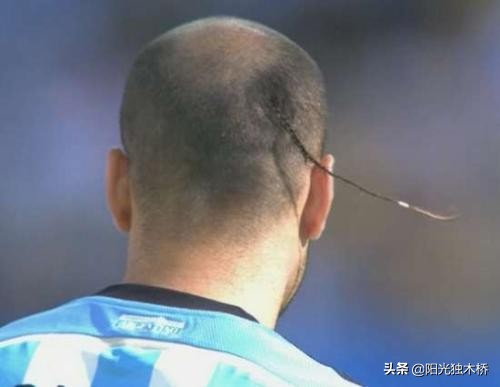 足球运动员短发发型,足球界最奇怪的10个发型