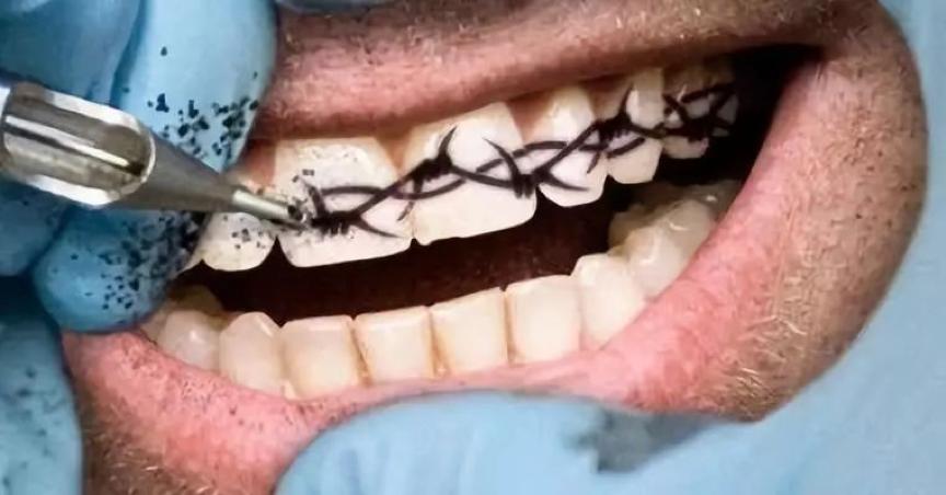 全球流行纹身,牙齿纹身图