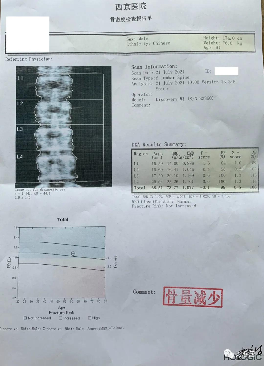 病例左侧躯体麻木,右侧肢体麻木典型病例
