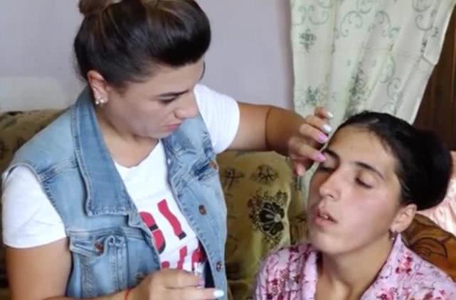 女子得了罕见怪病眼睛流出血,女子眼睛流出钻石眼泪