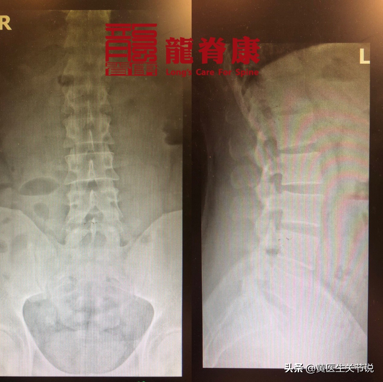 办公室久坐腰痛的缓解方法,久坐腰痛背疼的缓解方法