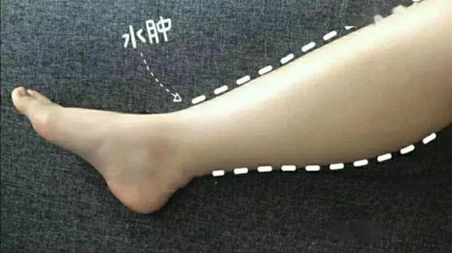 脚踝显瘦,脚踝粗要怎么瘦