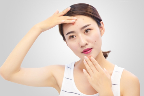 祛完痘留下好多痘印怎么消除,痘痘留下的黑印怎么祛