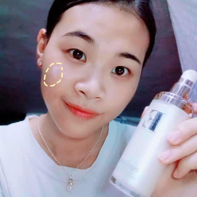 孕期用凯妮汀安全吗,孕妇可以用艾璐卡护肤