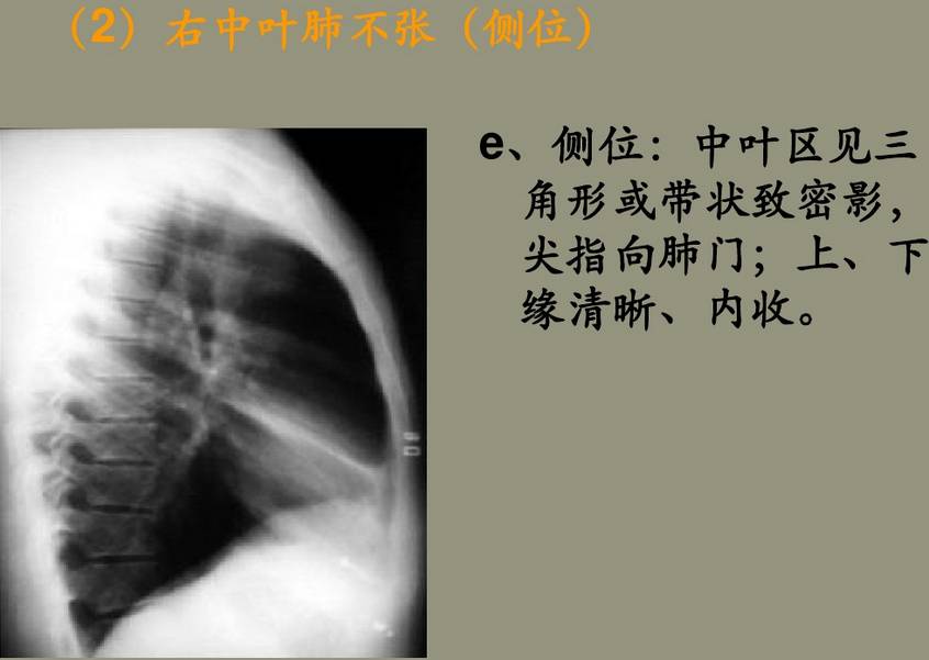 x线诊断边界模糊,x线诊断有误区吗