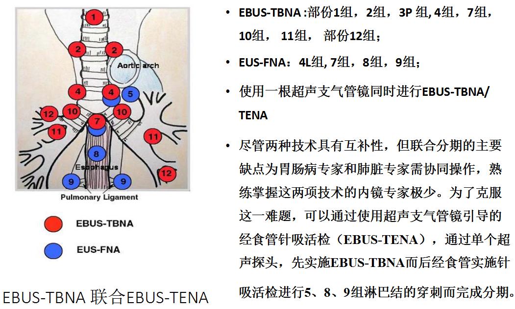 小细胞肺癌的气管镜介入治疗,导航支气管镜在肺癌诊断中的应用