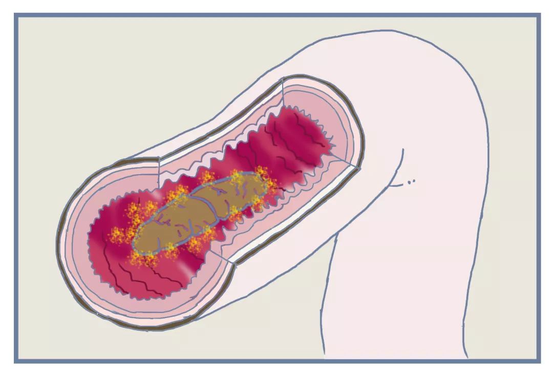 目前最前沿的便秘药,治便秘的药测评