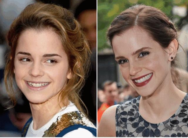 山西“爱马仕”级别齿科医院！get明星同款笑容