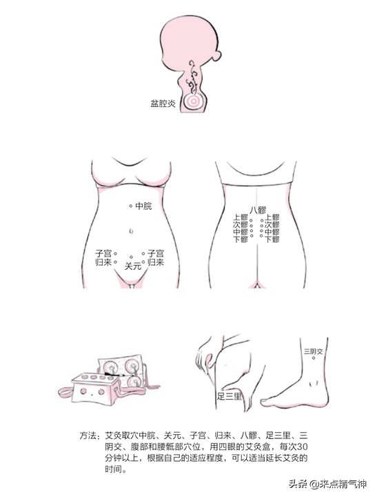 不孕症科普健康知识,切勿走入不孕症的治疗误区