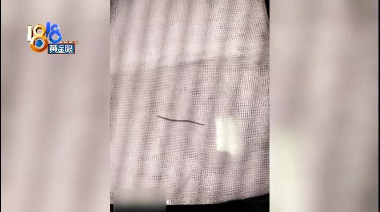 金属丝划破孩子心脏，家长推测“钢丝刷”