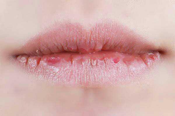 邓紫棋小红瓶,邓紫棋的金鱼嘴视频