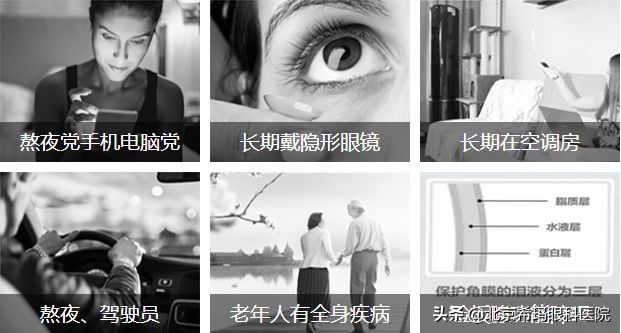 眼干来滴眼药水？年轻人，这些治疗方式比滴眼药水好使多了