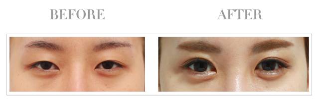 导致衰老的是哪个器官,导致衰老的原因