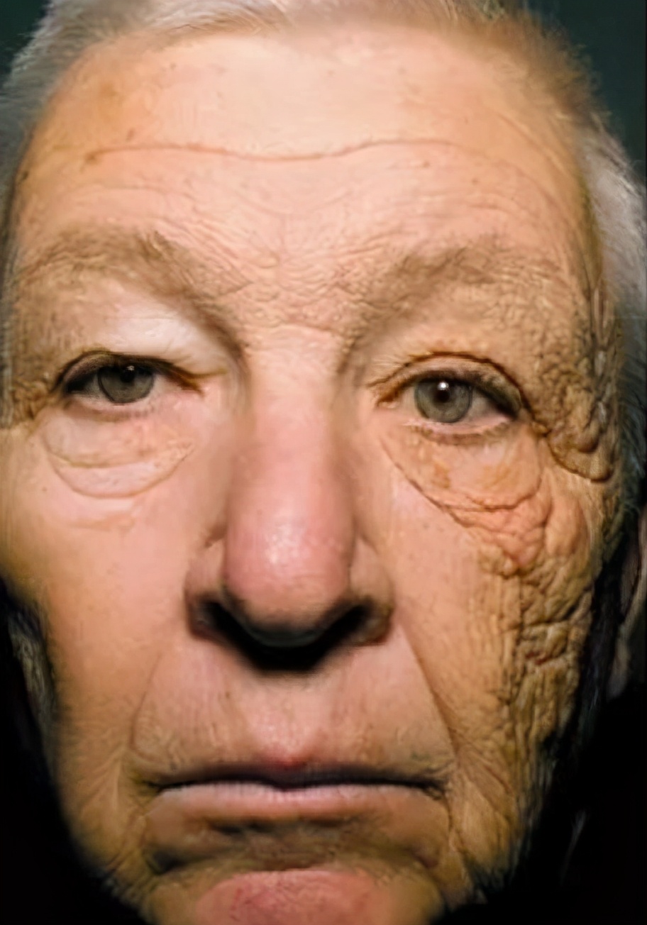 秋季滋润皮肤干燥的汤,秋季怎么保养皮肤