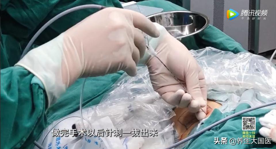 身体里长“石头”怎么办？三种治疗方式，助你恢复健康