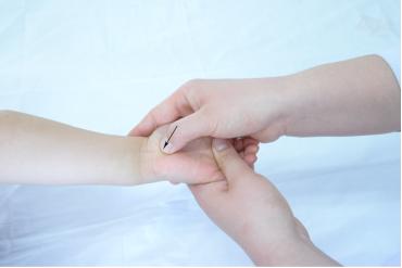 济宁推拿小儿斜颈,医院小儿推拿夜间门诊