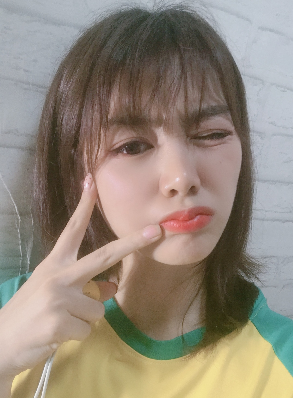 光子嫩肤540,480nm光子嫩肤