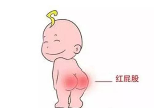 宝妈屁股红怎么办,小宝宝屁股通红又痛怎么办