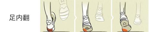 偏瘫足内翻足外翻,足内翻足外翻崴脚